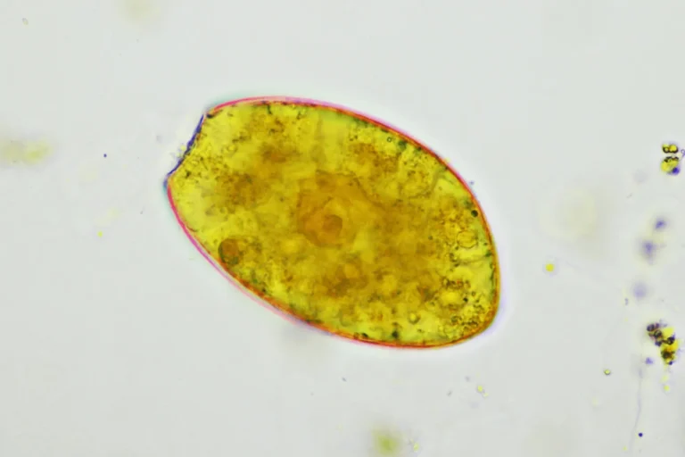 Co łączy chorobę pasożytniczą z zawrotami głowy?