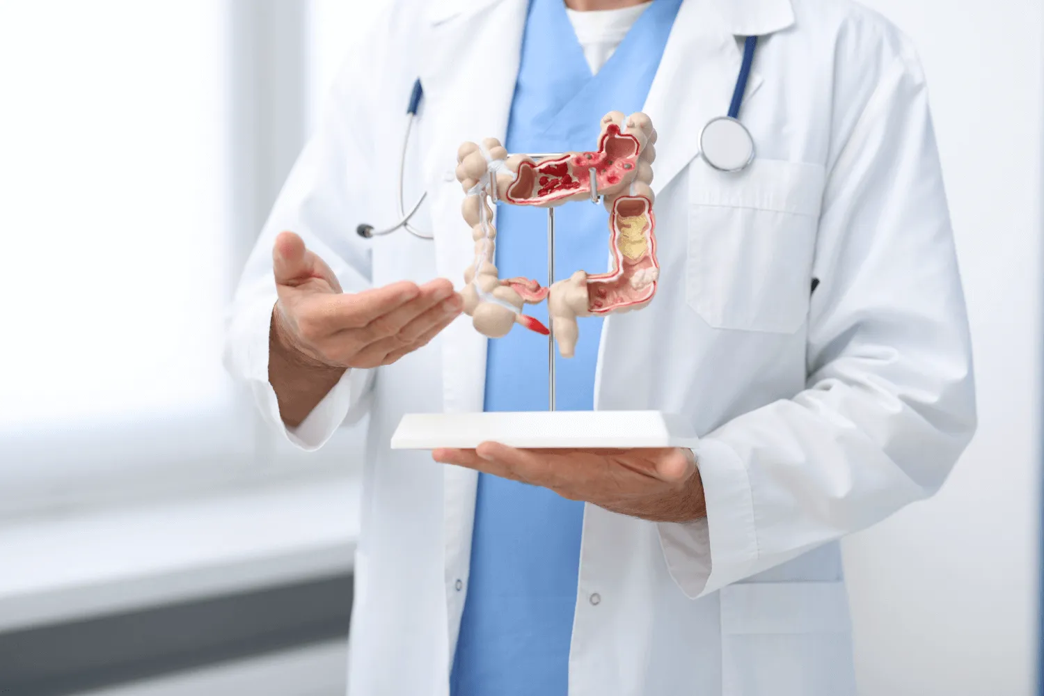 Zapalenie uchyłków jelita